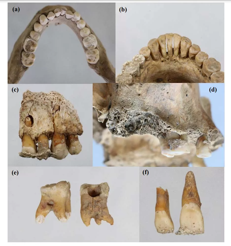 Material sobre el Estudio Antropológico de la Tebaida Berciana (3)