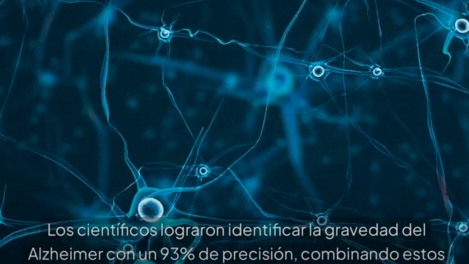 Nueva prueba para detectar el alzhéimer en una fase temprana 